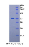 ITGB3 / Integrin Beta 3 / CD61 Protein - Recombinant Integrin Beta 3 By SDS-PAGE