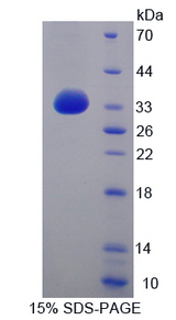 ITGB4 / Integrin Beta 4 Protein - Recombinant  Integrin Beta 4 By SDS-PAGE