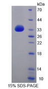 ITGB4 / Integrin Beta 4 Protein - Recombinant  Integrin Beta 4 By SDS-PAGE