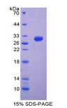ITGB5 / Integrin Beta 5 Protein - Recombinant Integrin Beta 5 By SDS-PAGE