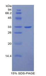 ITIH1 Protein - Recombinant Inter Alpha-Globulin Inhibitor H1 By SDS-PAGE