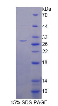 ITIH4 Protein - Recombinant Inter Alpha-Globulin Inhibitor H4 (ITIH4) by SDS-PAGE