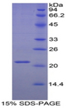ITIH5 Protein