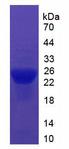 ITIH5 Protein - Recombinant Inter Alpha-Globulin Inhibitor H5 By SDS-PAGE
