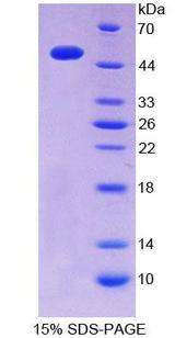 ITPA Protein - Recombinant  InosineTriphosphatase(ITPA) By SDS-PAGE