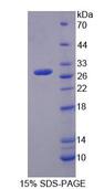 IVD Protein - Recombinant Isovaleryl Coenzyme A Dehydrogenase (IVD) by SDS-PAGE