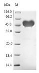 JAG1 / Jagged 1 Protein - (Tris-Glycine gel) Discontinuous SDS-PAGE (reduced) with 5% enrichment gel and 15% separation gel.