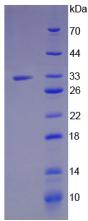 JAG1 / Jagged 1 Protein - Recombinant Jagged 1 Protein By SDS-PAGE
