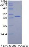 JAG2 / Jagged-2 Protein - Recombinant Jagged 2 Protein By SDS-PAGE