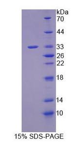 JPH3 Protein - Recombinant Junctophilin 3 (JPH3) by SDS-PAGE