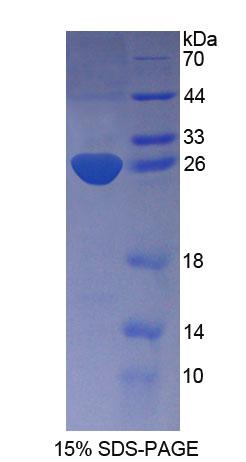 KATNA1 Protein - Recombinant  Katanin P60 Subunit A 1 By SDS-PAGE