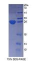 KATNA1 Protein - Recombinant  Katanin P60 Subunit A 1 By SDS-PAGE