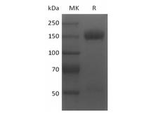 KDR / VEGFR2 / FLK1 Protein - Recombinant Mouse VEGF Receptor 2/VEGF R2/FLK-1/KDR (C-Fc)