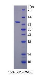 KEAP1 Protein - Recombinant  Kelch Like ECH Associated Protein 1 By SDS-PAGE