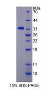 KERA / Keratocan Protein - Recombinant  Keratocan By SDS-PAGE