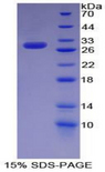 KHDRBS1 / SAM68 Protein - Recombinant KH Domain Containing, RNA Binding, Signal Transduction Associated Protein 1 By SDS-PAGE