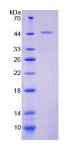 KISS1 / Kisspeptin / Metastin Protein - Recombinant  Kisspeptin 1 By SDS-PAGE