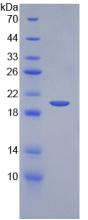 KITLG / SCF Protein - Recombinant Stem Cell Factor By SDS-PAGE