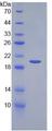 KITLG / SCF Protein - Recombinant Stem Cell Factor By SDS-PAGE