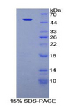 KLB / Beta Klotho Protein - Recombinant Klotho Beta (KLb) by SDS-PAGE