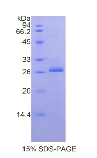KLK3 / PSA Protein - Recombinant Kallikrein 3 By SDS-PAGE