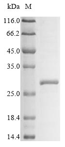 Klra3 / Ly49c Protein - (Tris-Glycine gel) Discontinuous SDS-PAGE (reduced) with 5% enrichment gel and 15% separation gel.