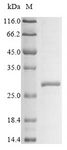 Klra3 / Ly49c Protein - (Tris-Glycine gel) Discontinuous SDS-PAGE (reduced) with 5% enrichment gel and 15% separation gel.