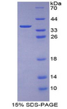 KRT1 / CK1 / Cytokeratin 1 Protein - Recombinant Keratin 1 By SDS-PAGE