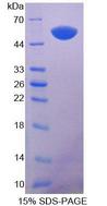 KRT14 / CK14 / Cytokeratin 14 Protein - Recombinant Keratin 14 By SDS-PAGE