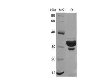KRT18 / CK18 / Cytokeratin 18 Protein - Recombinant Mouse KRT18 Protein (His Tag)-Elabscience