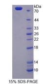 KRT28 / Keratin 28 Protein - Recombinant Keratin 28 By SDS-PAGE