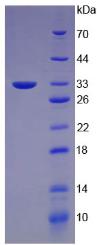 KRT5 / CK5 / Cytokeratin 5 Protein - Recombinant Keratin 5 By SDS-PAGE