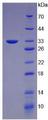 KRT5 / CK5 / Cytokeratin 5 Protein - Recombinant Keratin 5 By SDS-PAGE