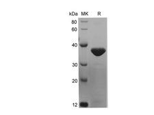 KRT7 / CK7 / Cytokeratin 7 Protein - Recombinant Mouse KRT7 Protein (His Tag)-Elabscience