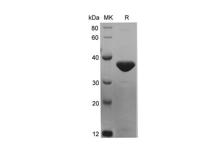 KRT7 / CK7 / Cytokeratin 7 Protein - Recombinant Mouse KRT7 Protein (His Tag)-Elabscience