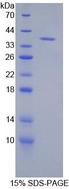 KRT71 / Keratin 71 Protein - Recombinant Keratin 71 By SDS-PAGE