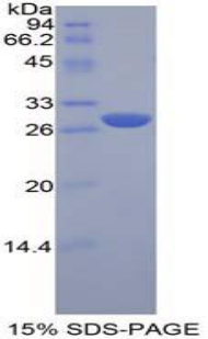 LAG3 Protein - Recombinant Lymphocyte Activation Gene 3 By SDS-PAGE