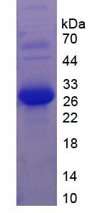 LAMA2 / Merosin Protein - Recombinant Laminin Alpha 2 By SDS-PAGE