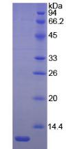 LAMB2 / Laminin Beta 2 Protein - Recombinant Laminin Beta 2 By SDS-PAGE