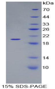 LAMB3 / Laminin Beta 3 Protein - Recombinant Laminin Beta 3 By SDS-PAGE