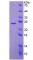 LAMB3 / Laminin Beta 3 Protein - Recombinant Laminin Beta 3 By SDS-PAGE