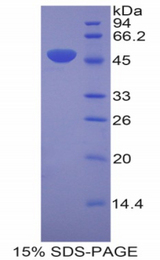 LAMC2 / Laminin Gamma 2 Protein - Recombinant Laminin Gamma 2 By SDS-PAGE