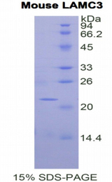 LAMC3 / Laminin Gamma 3 Protein - Recombinant Laminin Gamma 3 By SDS-PAGE
