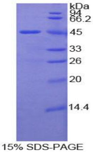 LAMP2 / CD107b Protein - Recombinant Lysosomal Associated Membrane Protein 2 By SDS-PAGE