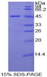 LAMP2 / CD107b Protein - Recombinant Lysosomal Associated Membrane Protein 2 By SDS-PAGE