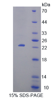 LAT2 / NTAL Protein - Recombinant  Linker For Activation Of T-Cells Family, Member 2 By SDS-PAGE