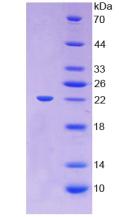 LCAT Protein - Active Lecithin Cholesterol Acyltransferase (LCAT) by SDS-PAGE