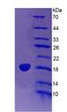 LCAT Protein - Recombinant Lecithin Cholesterol Acyltransferase By SDS-PAGE