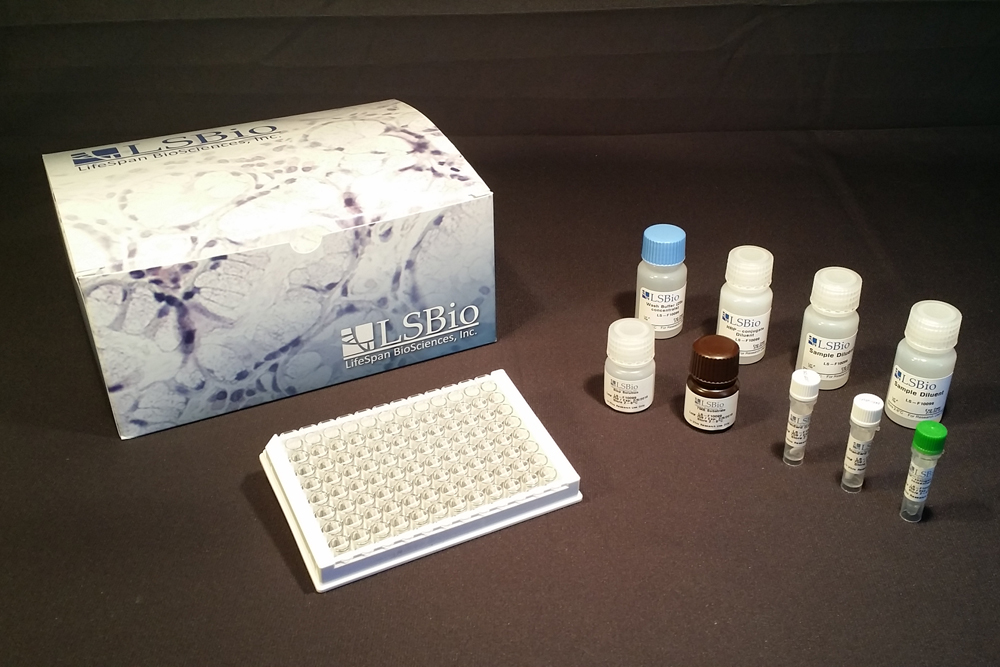 LCN2 / Lipocalin 2 / NGAL ELISA Kit