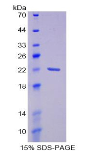 LCN2 / Lipocalin 2 / NGAL Protein - Recombinant Neutrophil Gelatinase Associated Lipocalin By SDS-PAGE